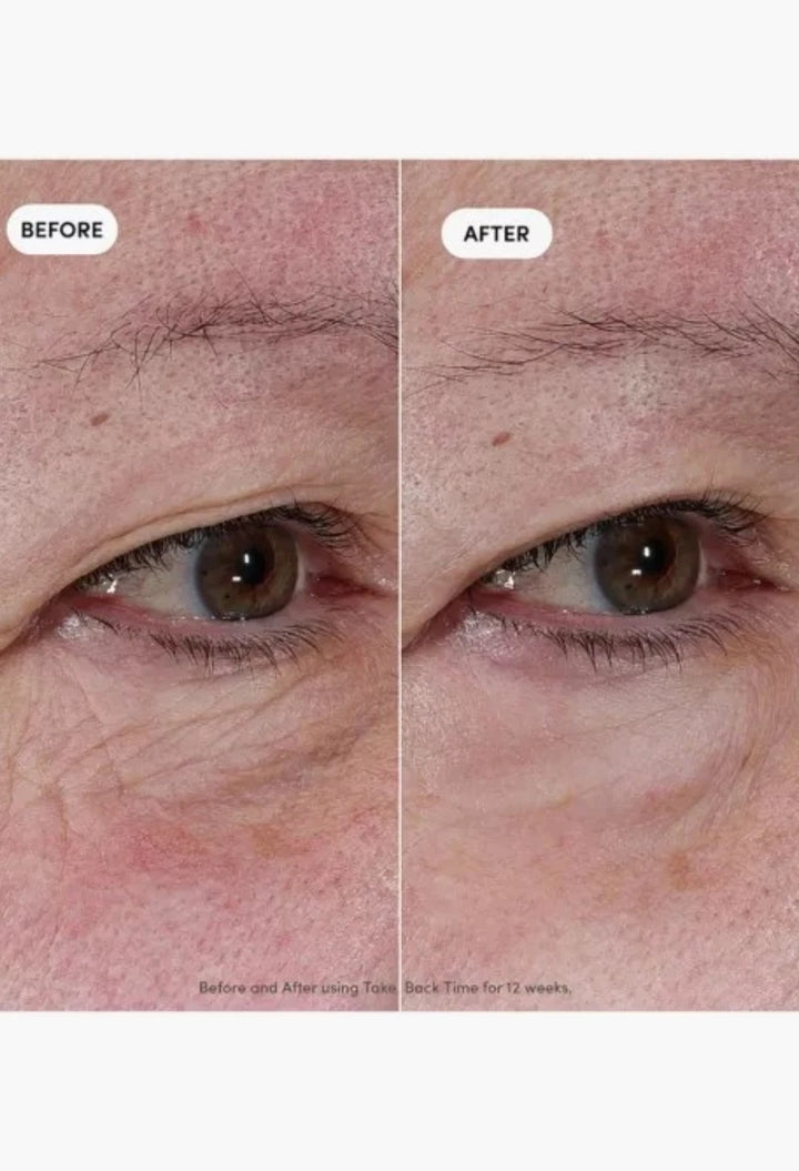 Take Back Time Miniprotein™ Eye Treatment