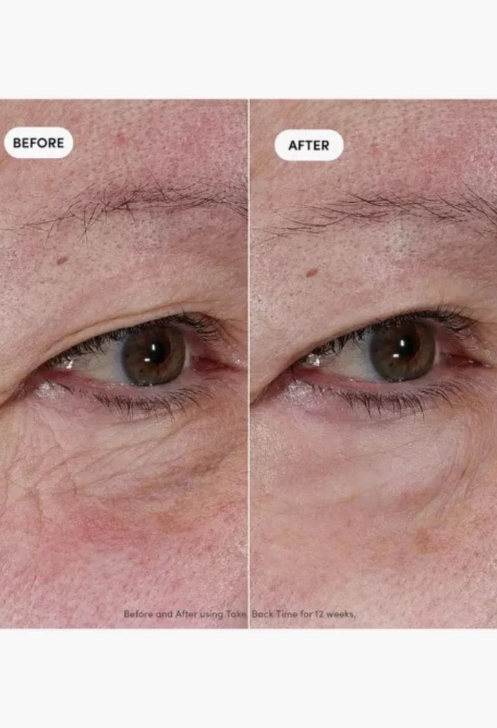 Trinny London Take Back Time Miniprotein Eye Treatment