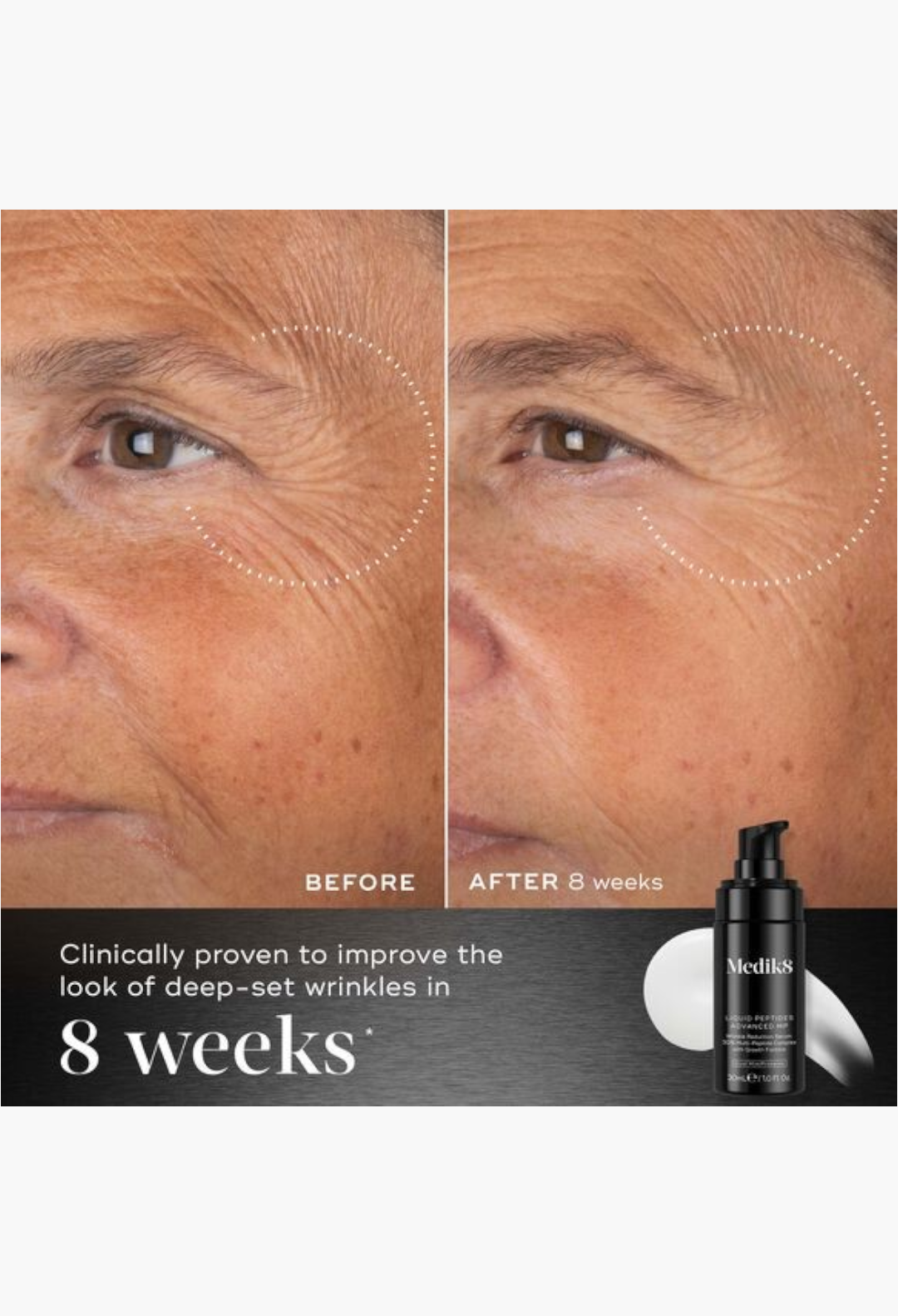 GLAM MODA Medik8 Liquid Peptides Advanced MP serum showing before and after results on mature skin with wrinkles