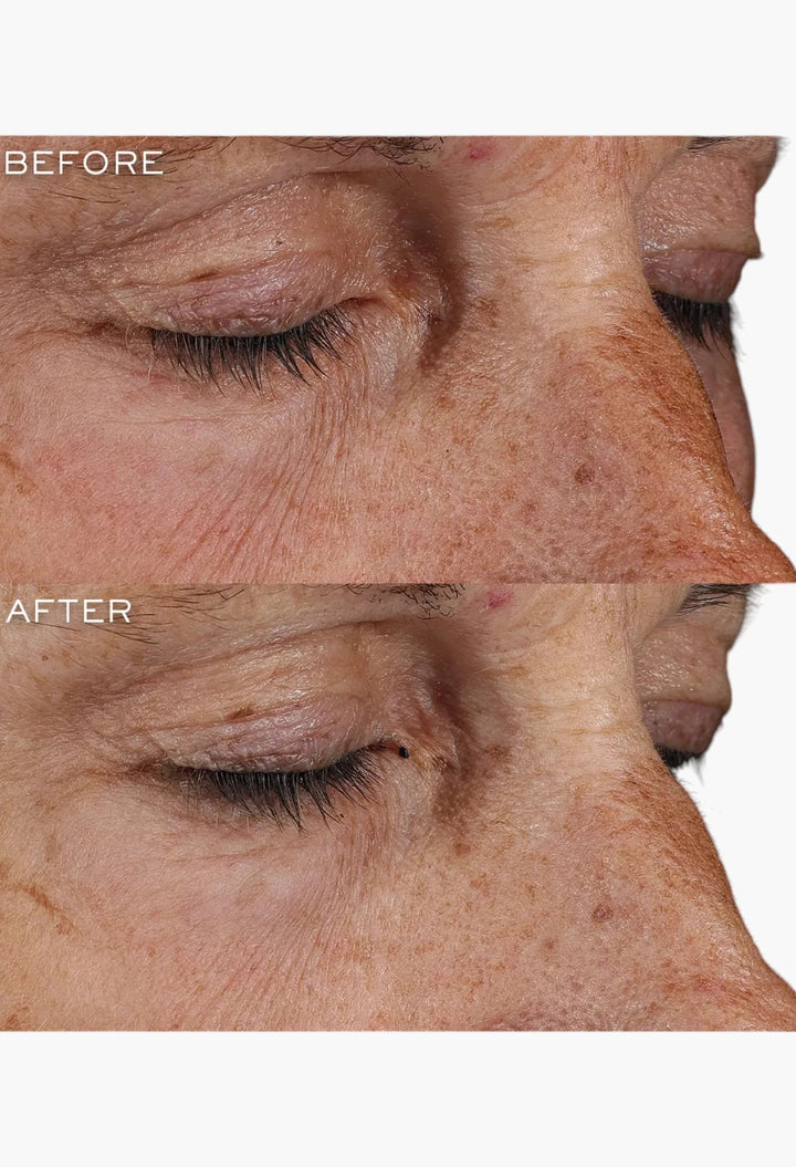 Génifique Ultimate Eye Cream,
