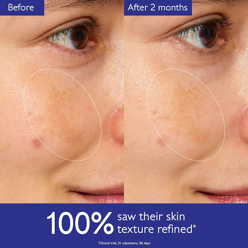 Vinoperfect Brightening Glycolic Essence - GLAM MODA