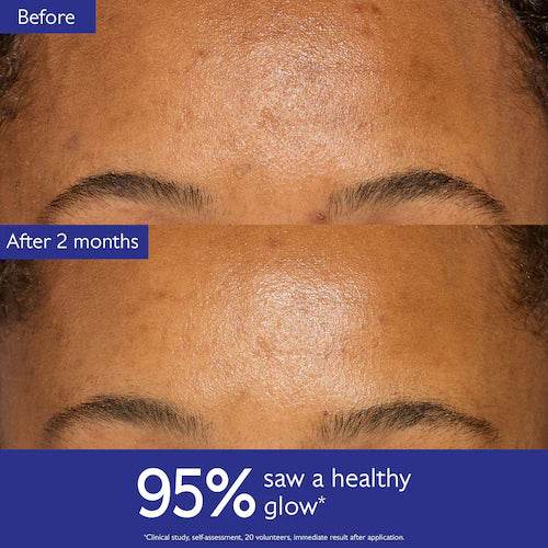 Vinoperfect Brightening Refillable Moisturizer with Niacinamide - GLAM MODA