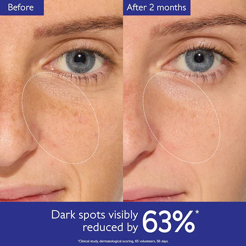 Vinoperfect Brightening Routine For Dark Spots And Uneven Skin Tone - GLAM MODA