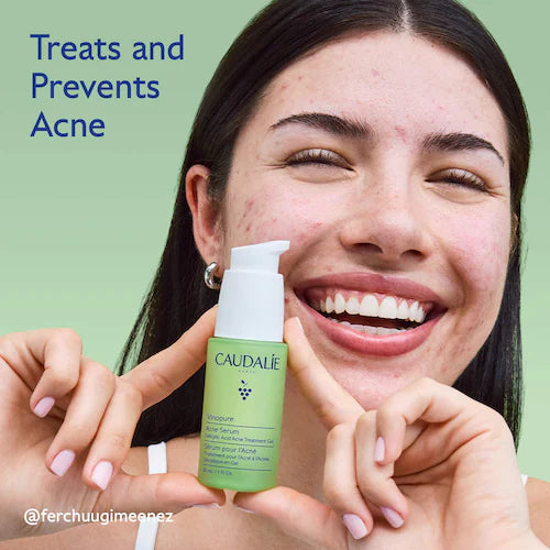 Vinopure Acne Serum to Treat and Prevent Blemishes - GLAM MODA