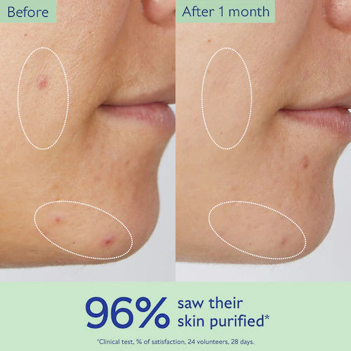 Vinopure Pore Purifying Gel Cleanser - GLAM MODA