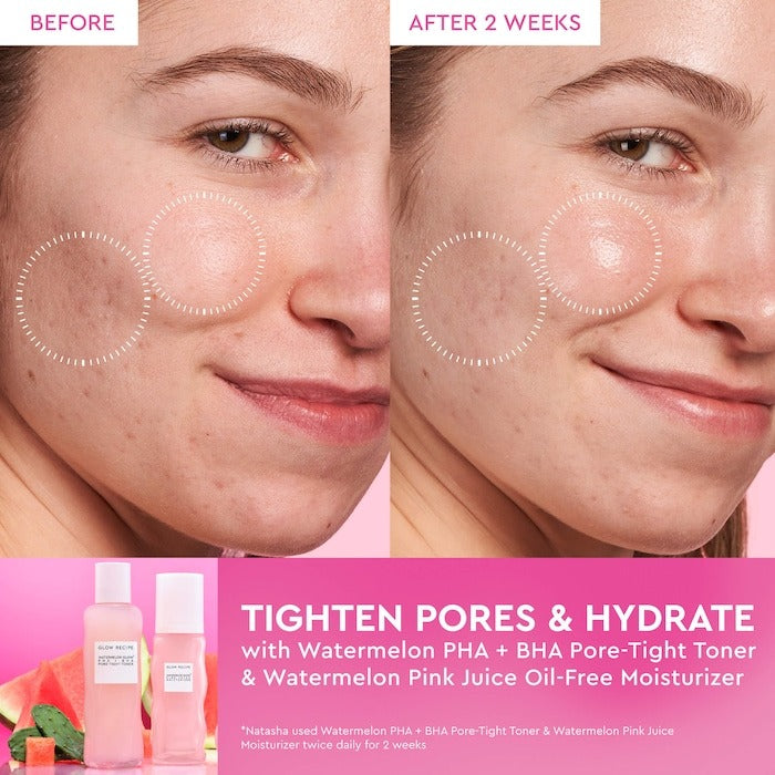 Watermelon Glow PHA + BHA Pore-Tight Toner - GLAM MODA
