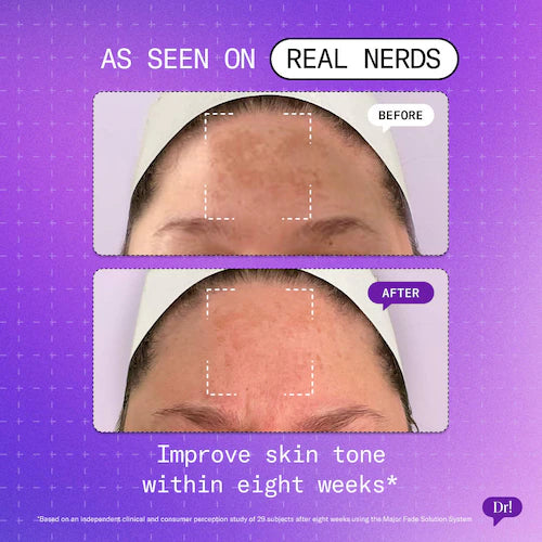 Major Fade Hyper Serum Dark Spot + Hyperpigmentation Treatment with Niacinamide and Glycerin - GLAM MODA