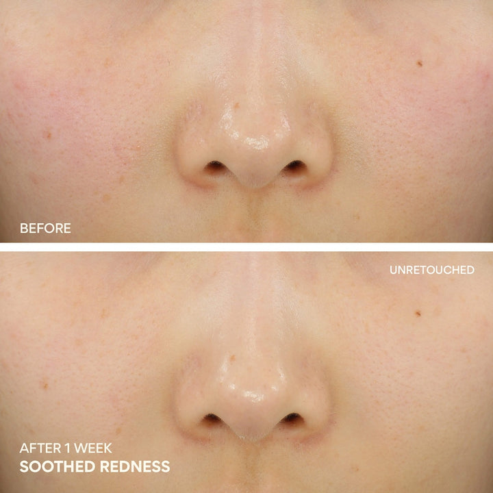 Green Tea Ceramide Cream for Redness & Barrier Repair - GLAM MODA