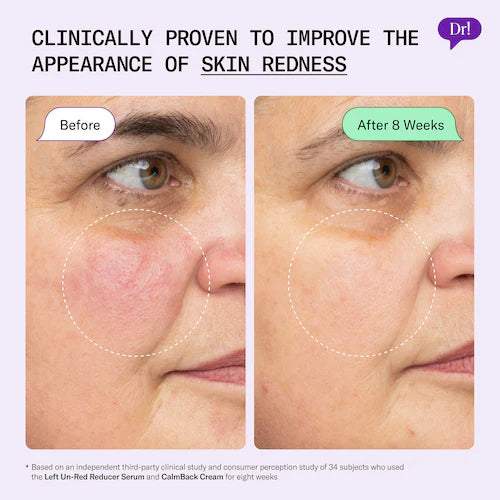 Left Un-Red Reducer Face Serum for Redness and Blemish Prone Skin - GLAM MODA