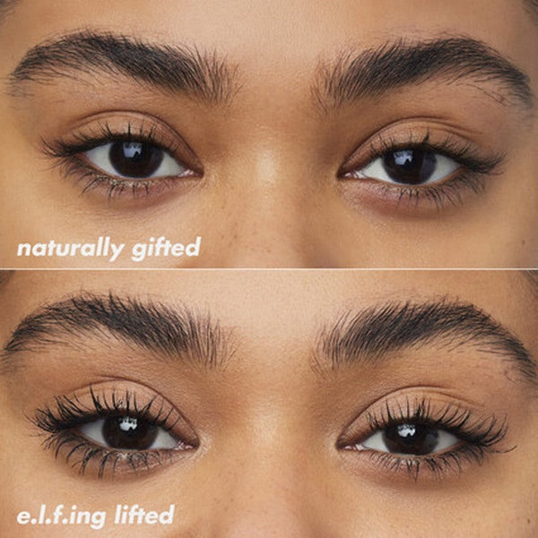 Brow Lift