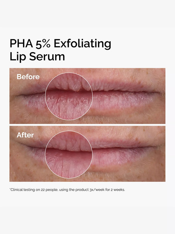 PHA 5% Exfoliating Lip Serum