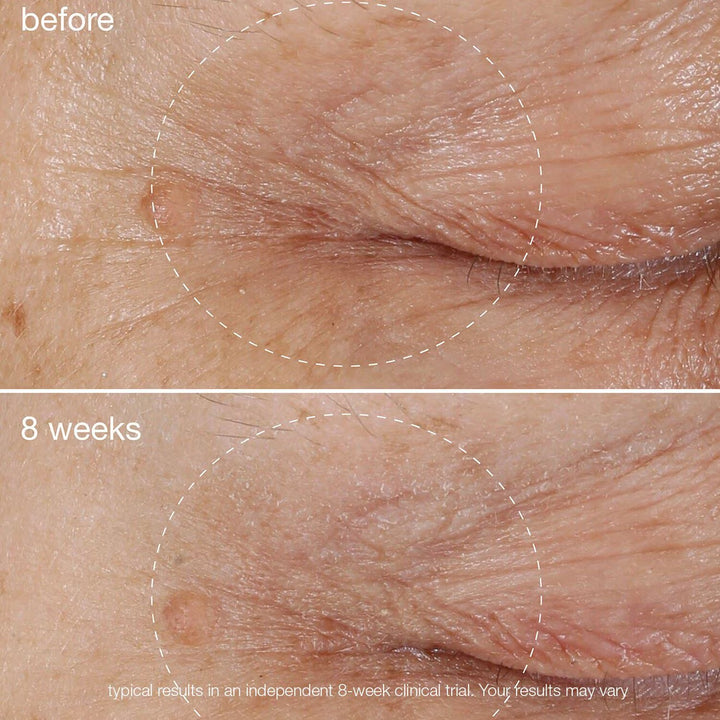 Biolumin-C Vitamin C Eye Serum - GLAM MODA