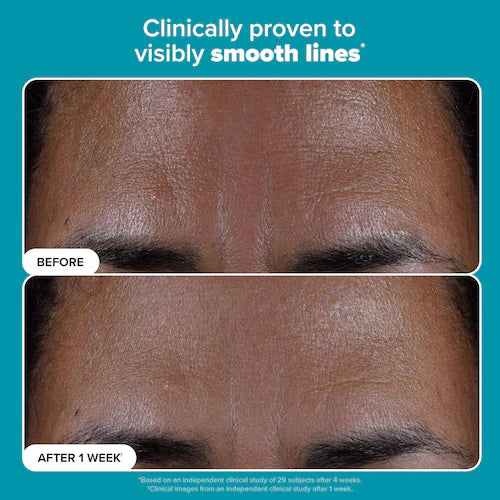 Skin Perfecting 2% BHA Exfoliating Toner For Clear Skin