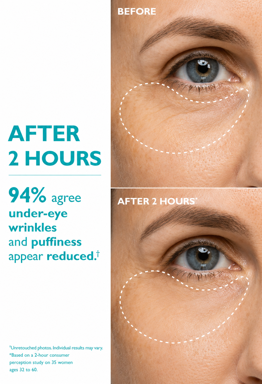 Peptide-Infused Face & Eye Tape for Wrinkles and Aging Skin