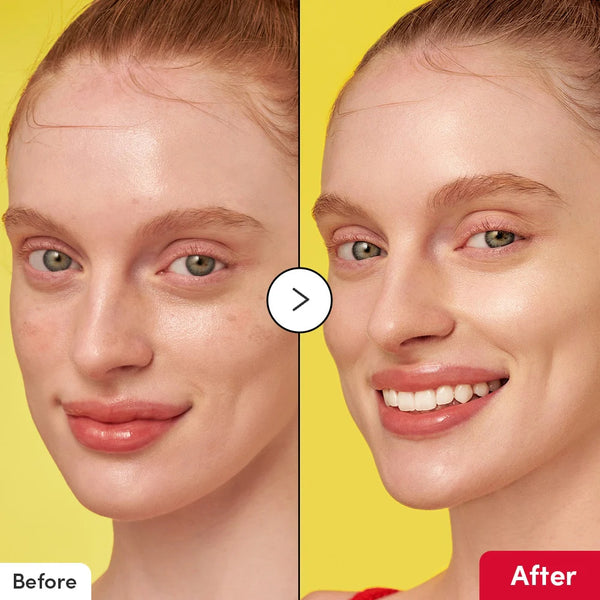 Vitamin Illuminating Serum - Brightens And Improves Dark Spots
