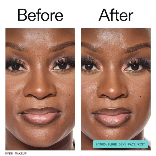 Hydro-Surge Dewy Face Mist - GLAM MODA