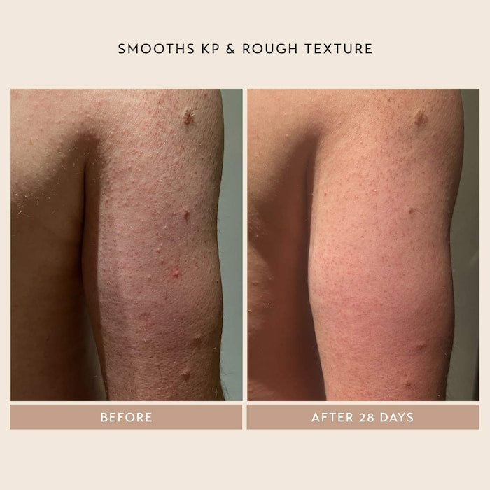 Body Reform Treatment Serum with 2% Granactive Retinoid - GLAM MODA