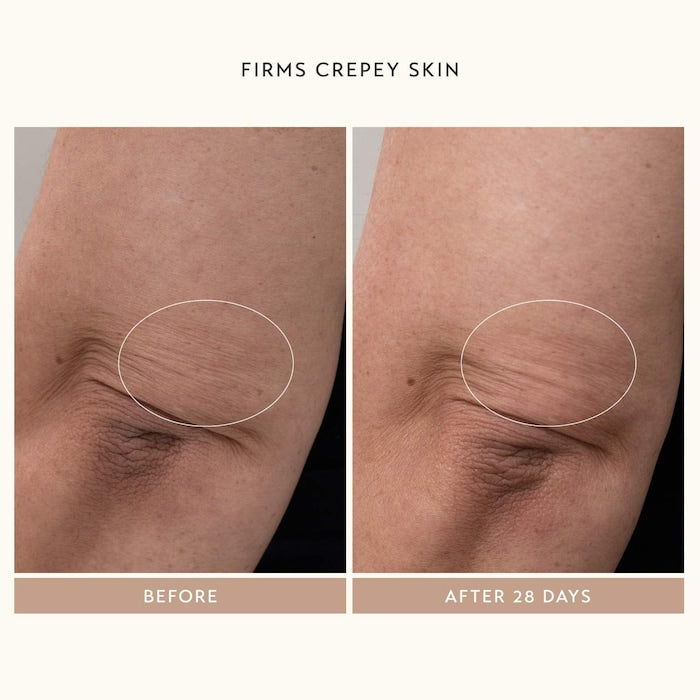 Body Reform Treatment Serum with 2% Granactive Retinoid - GLAM MODA