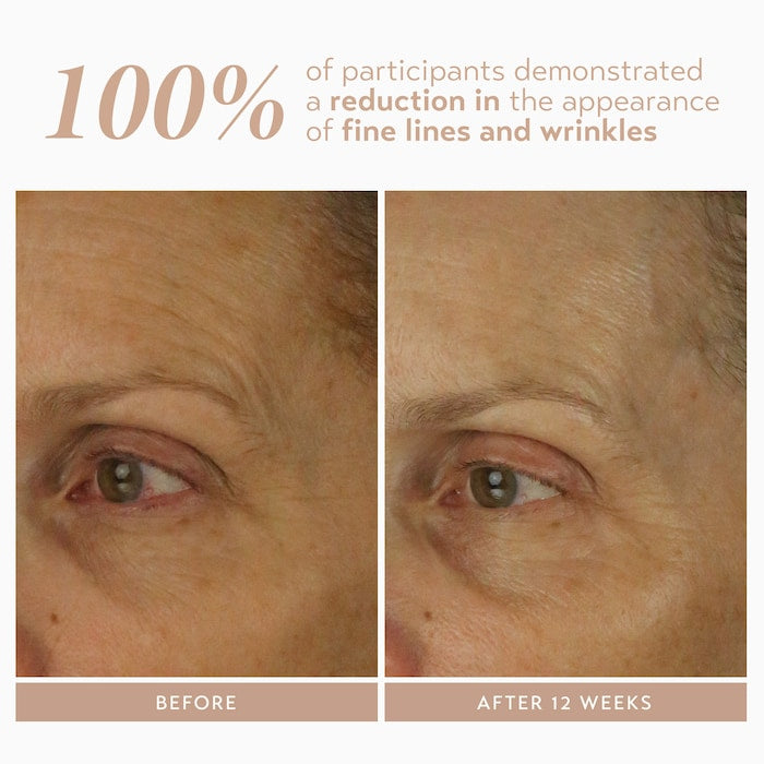 Retinol Reform® with 1% Encapsulated Retinol for Fine Lines & Wrinkles - GLAM MODA