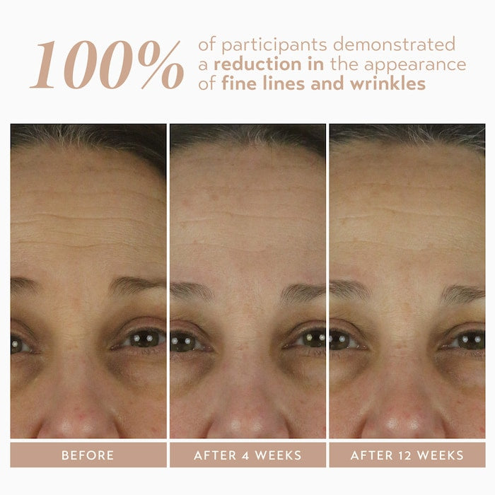 Retinol Reform® with 1% Encapsulated Retinol for Fine Lines & Wrinkles - GLAM MODA
