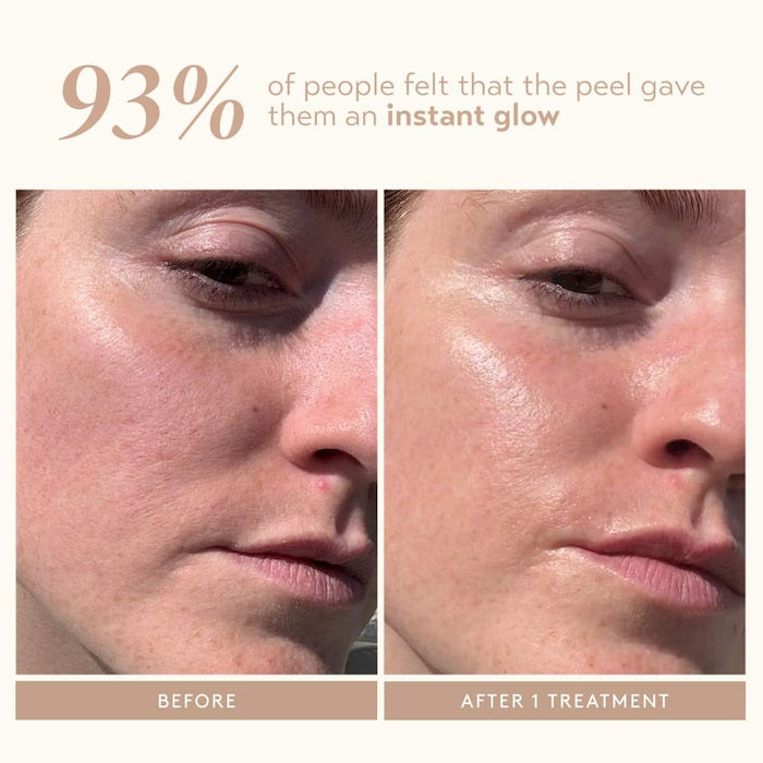 Triple Acid Signature Peel - GLAM MODA