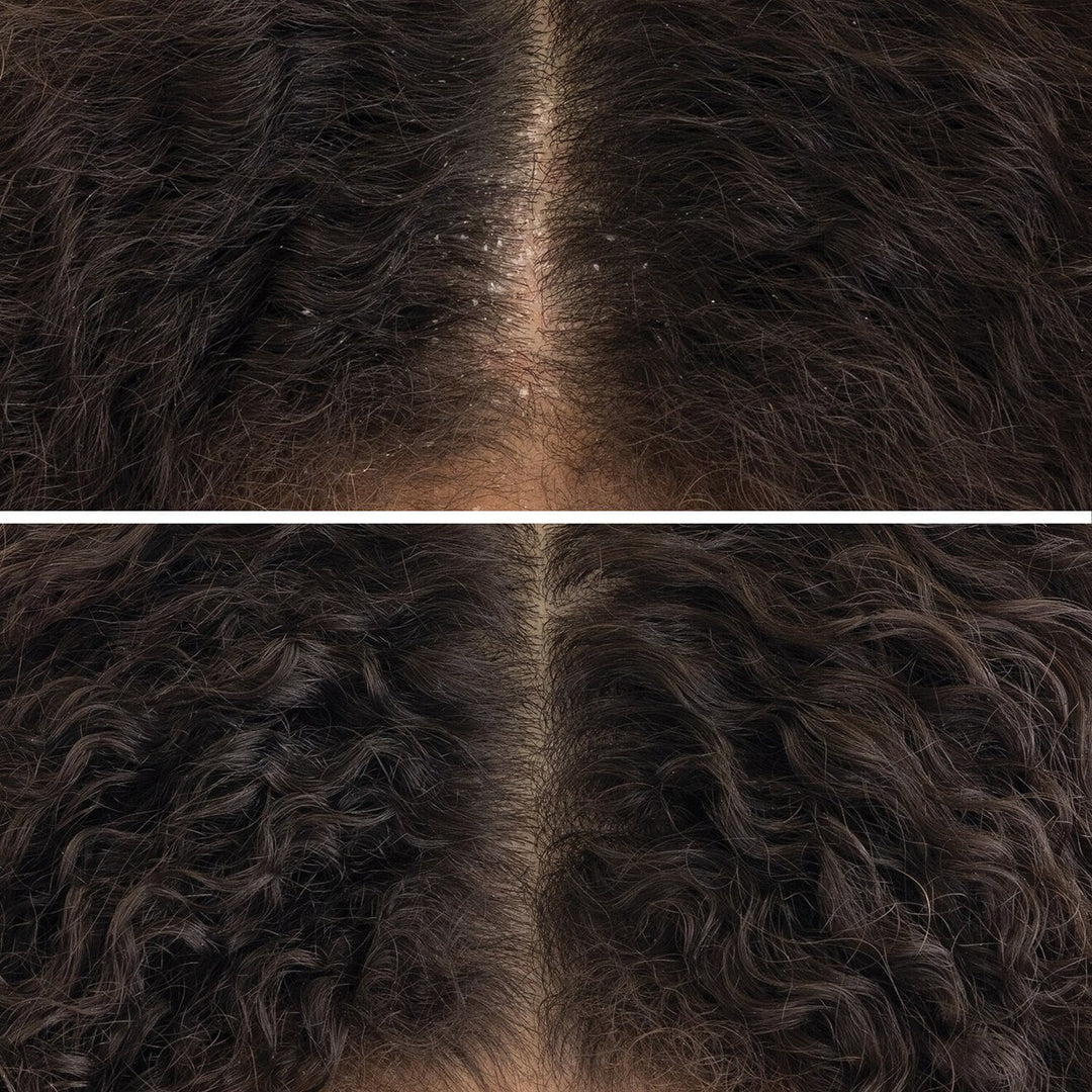 Crown Tonic Pre-Shampoo Scalp-Balancing Cleanser - GLAM MODA