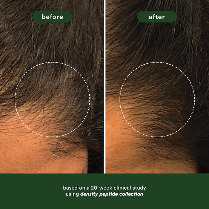 Density Peptide Scalp Serum for Thinning Hair - GLAM MODA