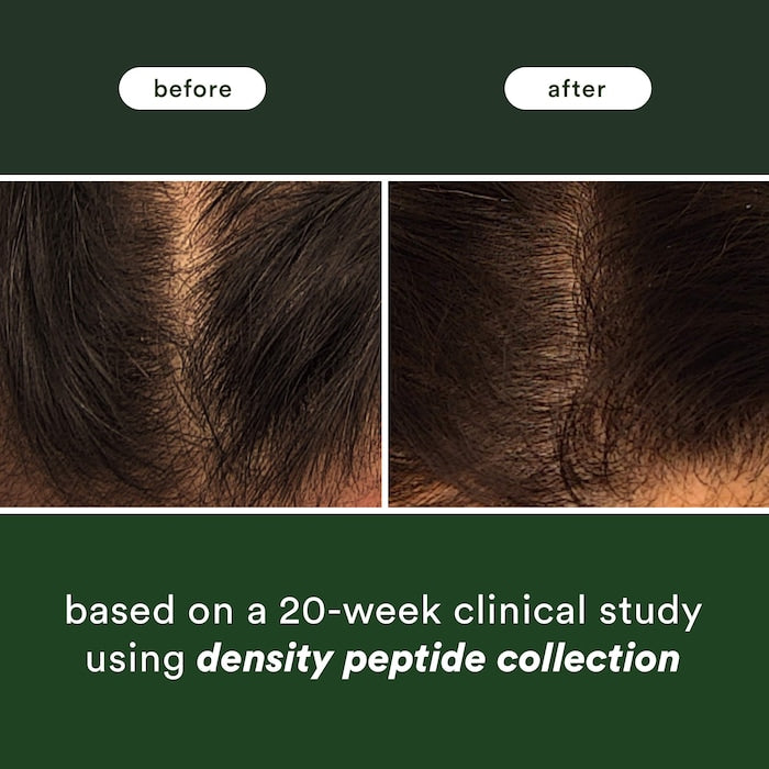 Density Peptide Scalp Serum for Thinning Hair - GLAM MODA