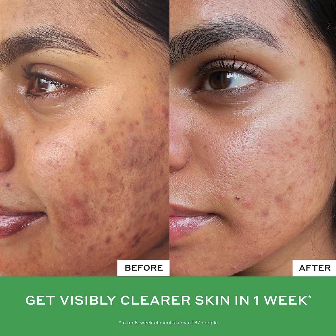 Daily D-Clog Pore-Clearing Cleanser - GLAM MODA