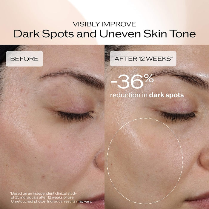 Benefiance Dark Spot and Wrinkle Smoothing Serum - GLAM MODA