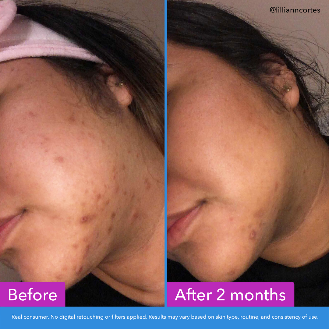 Discoloration Correcting Serum - GLAM MODA