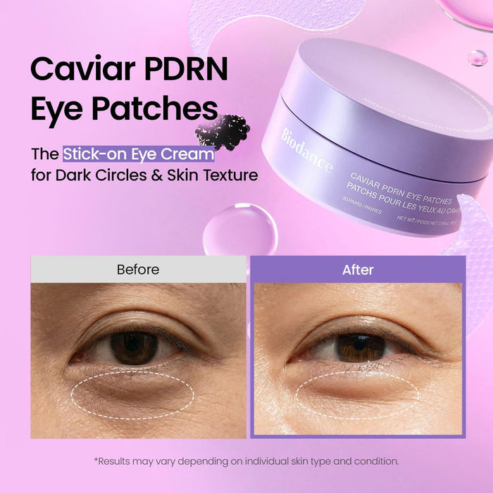 Caviar Pdrn Eye Patches - GLAM MODA