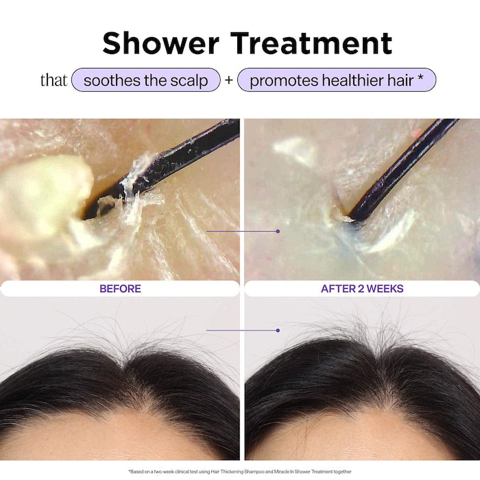 Miracle In Shower Scalp & Hair Hydrating Treatment for Hair Thinning - GLAM MODA