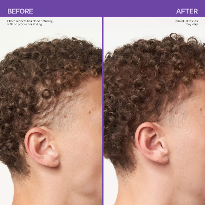 Miracle In Shower Scalp & Hair Hydrating Treatment for Hair Thinning - GLAM MODA