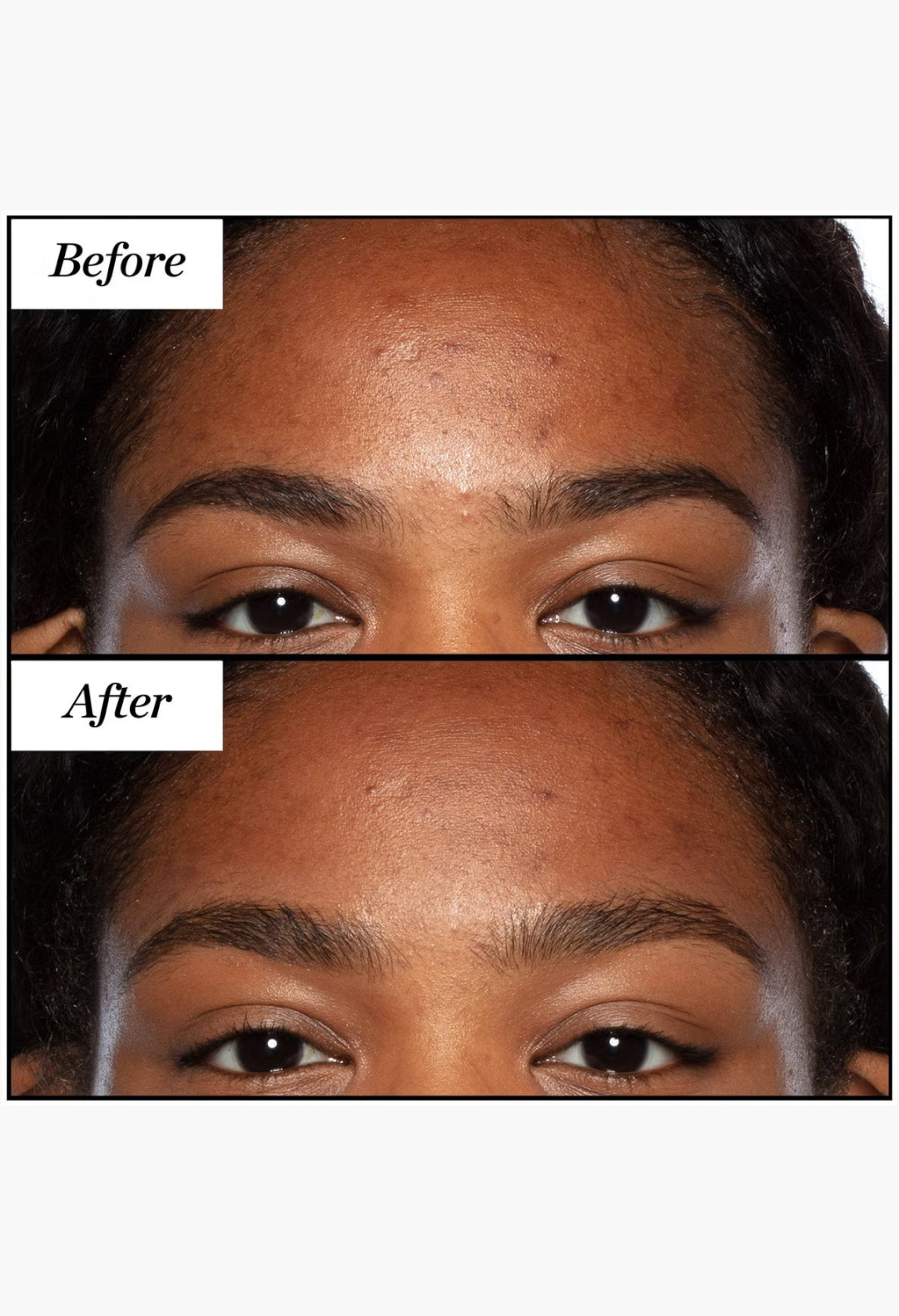 GLAM MODA before and after comparison of skin texture and clarity after using Sunday Riley Good Genes treatment