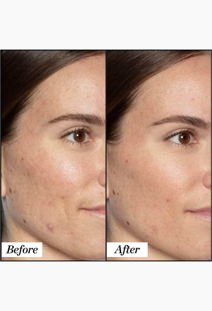 GLAM MODA before and after comparison of skin texture and radiance using Sunday Riley Good Genes lactic acid treatment
