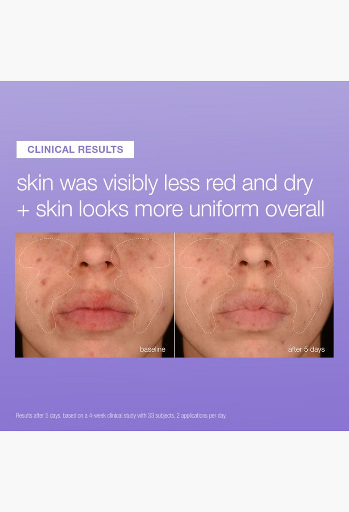 GLAM MODA clinical results showing reduced redness and improved skin uniformity after using Dermalogica repair serum