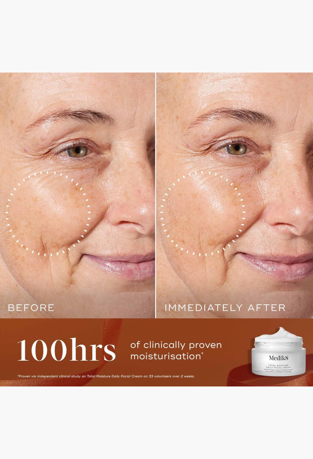 GLAM MODA Medik8 Radiance Ritual before and after comparison showing improved skin hydration and radiance on a face.