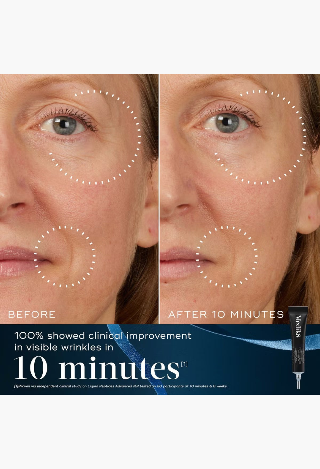 GLAM MODA Medik8 Age-Defying Essentials before and after comparison showing reduced fine lines on a woman's face