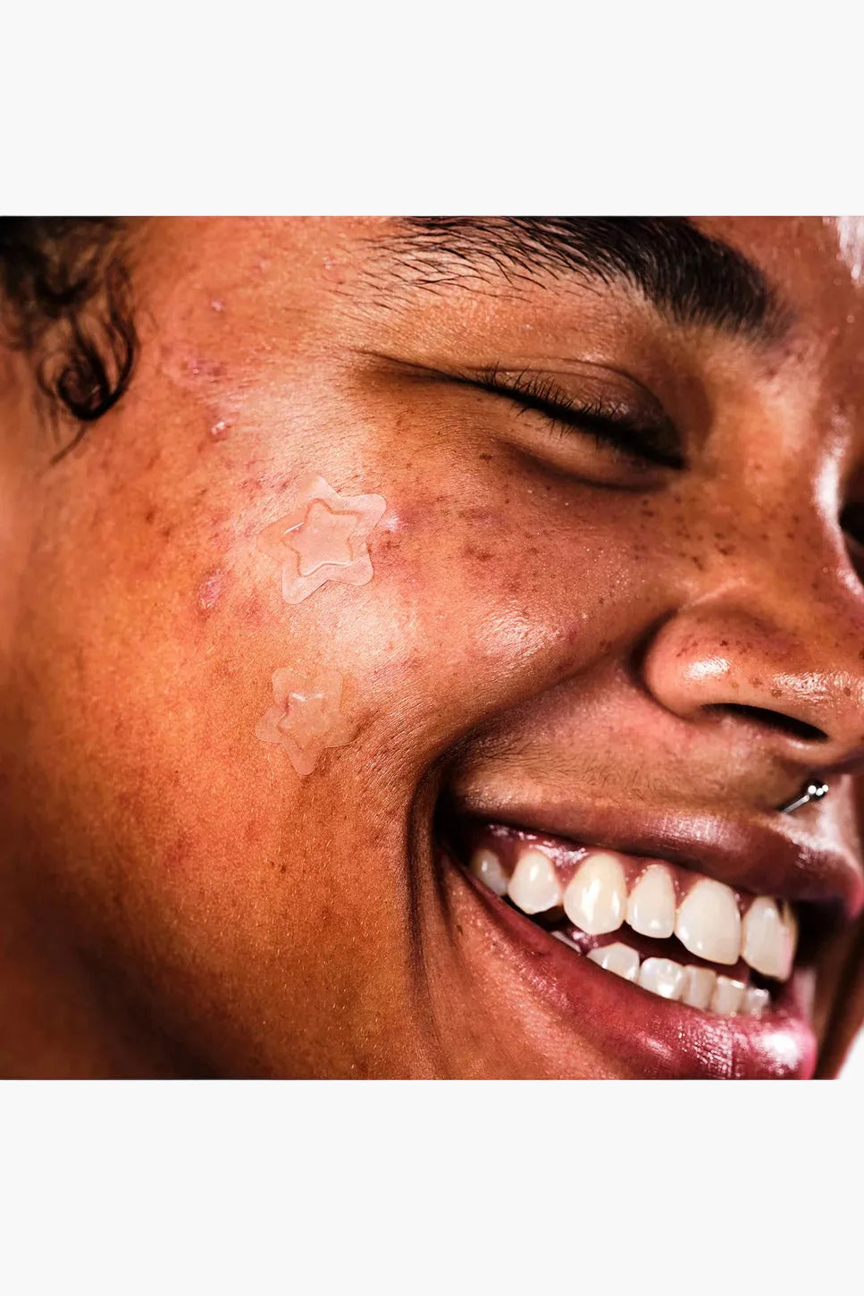 Hydro-Star Clear Pimple Patches