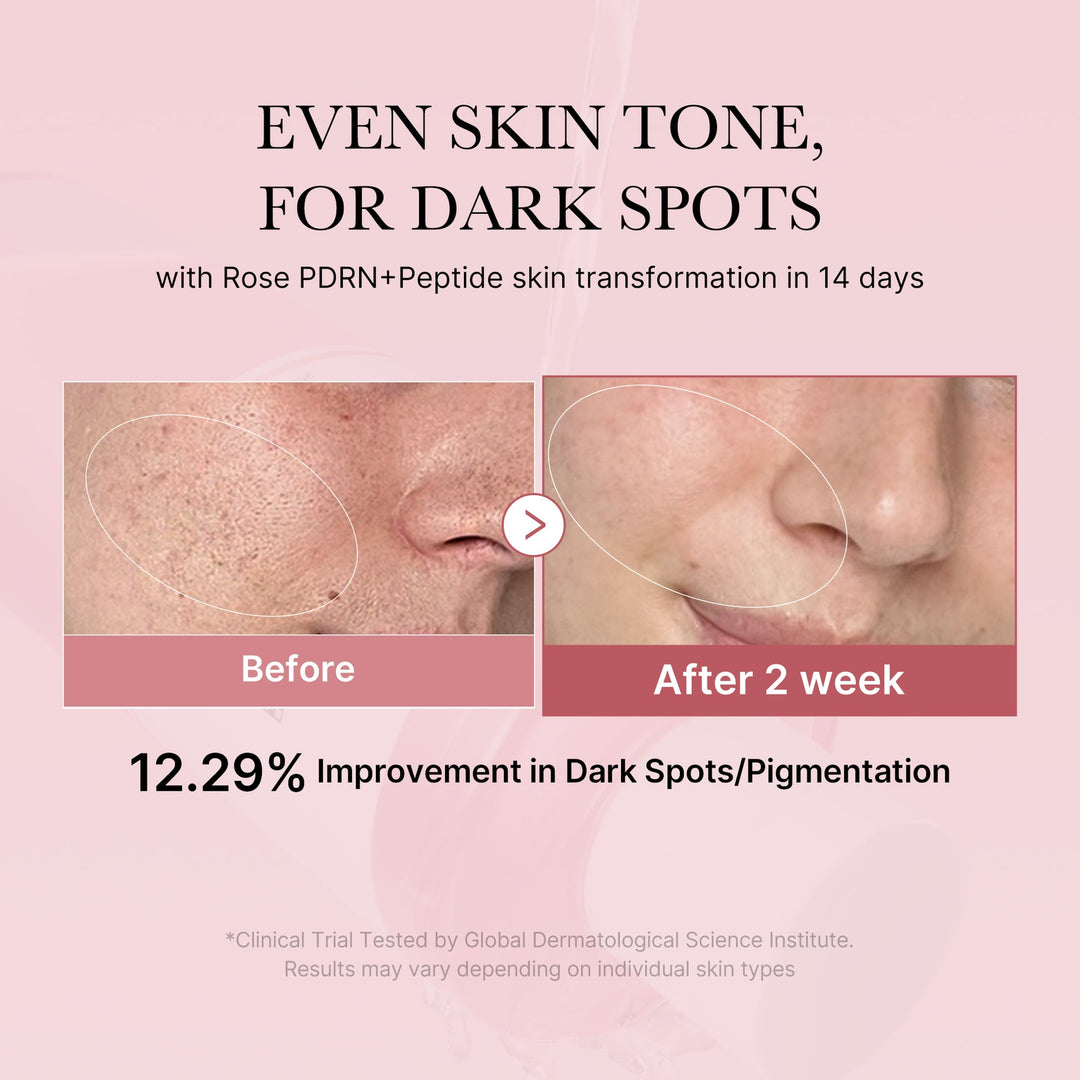 PDRN Pink Peptide Toner - Pink Glow Toner - GLAM MODA