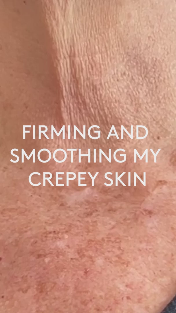 Body Reform Treatment Serum with 2% Granactive Retinoid