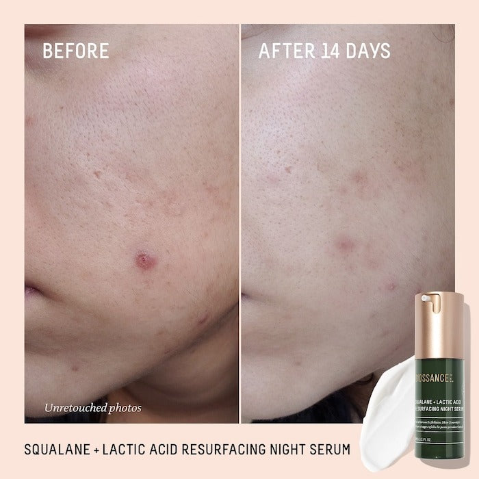 Squalane + 10% Lactic Acid Resurfacing Serum - GLAM MODA