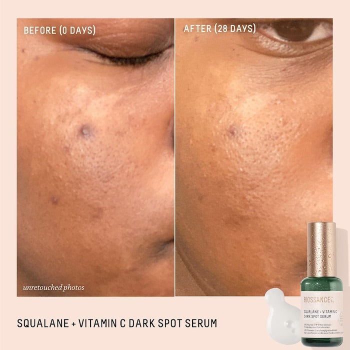 10% Vitamin C Dark Spot Serum + Squalane - GLAM MODA