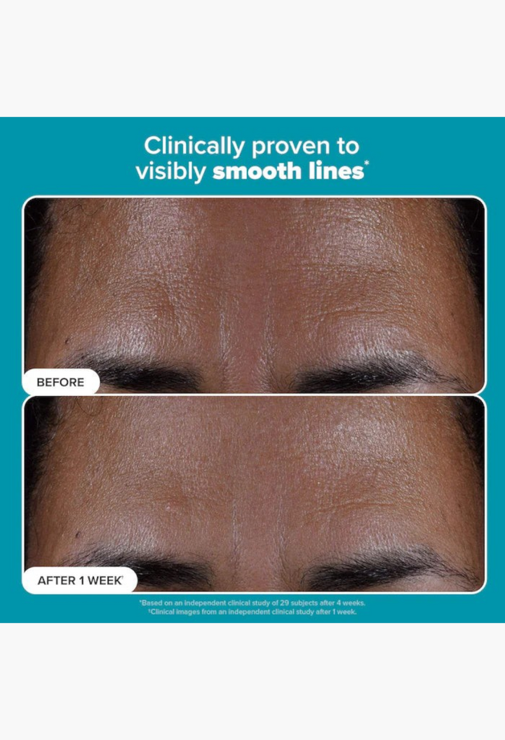 GLAM MODA before and after results showing reduced forehead lines and smoother skin texture after one week of use.