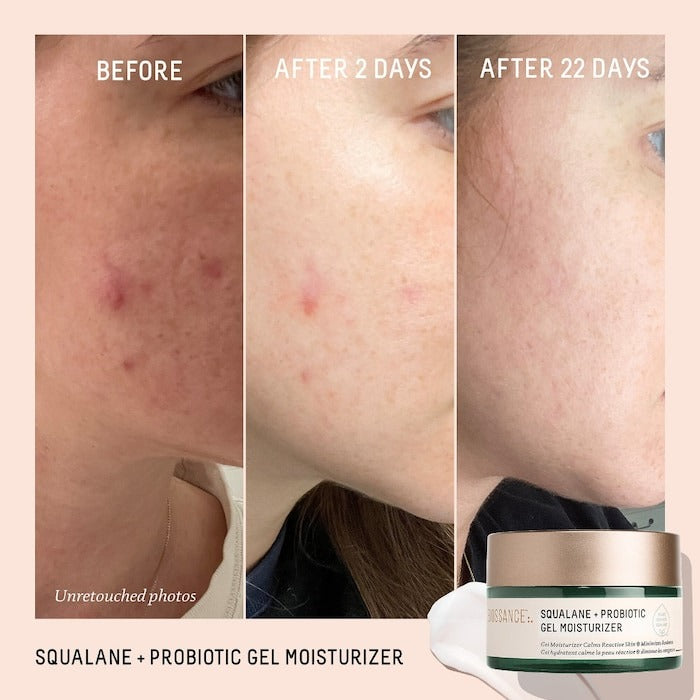 Probiotic Balancing Gel Moisturizer + Squalane - GLAM MODA