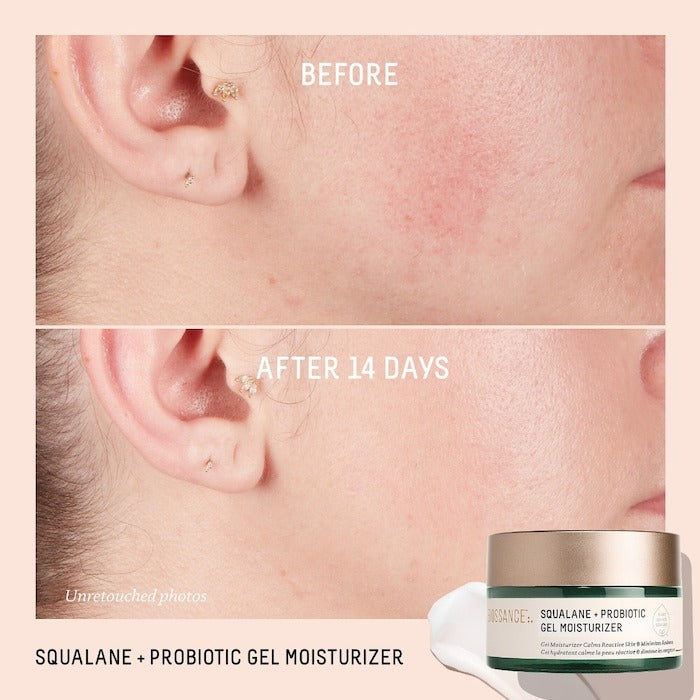Probiotic Balancing Gel Moisturizer + Squalane - GLAM MODA