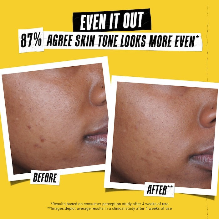 Better Screen™ UV Serum SPF 50+ Facial Sunscreen with Collagen Peptide - GLAM MODA