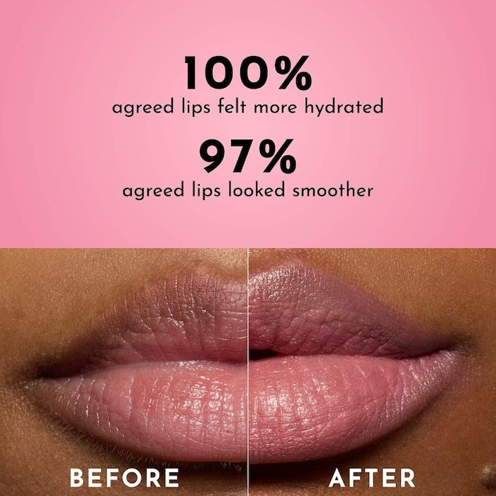 Forget the Filler Lip-Plumping Line-Smoothing Tinted Lip Balm - GLAM MODA