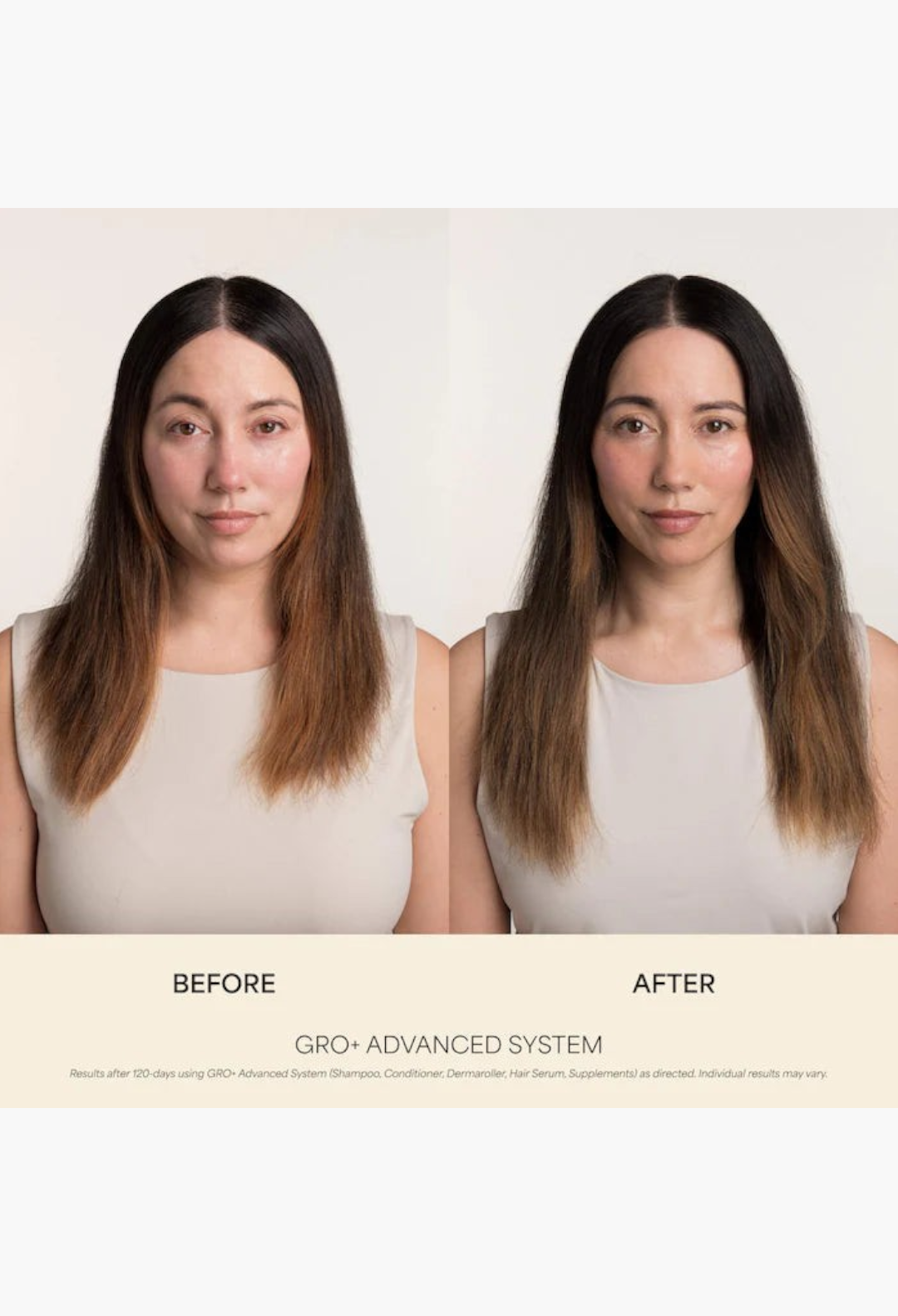 GLAM MODA before and after comparison of a woman showing hair density improvement using the GRO+ Advanced System.